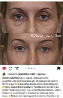 ������� �� ����������� ��� ����������
��������: 01271b04.jpg
����������: 183
������:	38,3 ��
ID:	402989