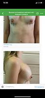     
: a48dd218.jpg
: 389
:	120,7 
ID:	403227