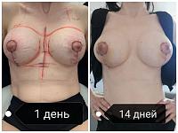     
: 0f97e388.jpg
: 82
:	47,2 
ID:	412285