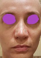     
: e67ddadd.jpg
: 102
:	22,7 
ID:	419397