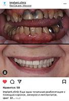 ������� �� ����������� ��� ����������
��������: b0020729.jpg
����������: 302
������:	49,6 ��
ID:	421193