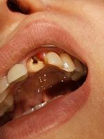     
: 701d84f7.jpg
: 56
:	26,7 
ID:	421673