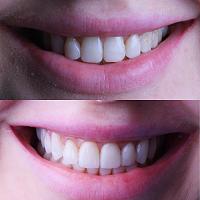 ������� �� ����������� ��� ����������
��������: 4d136ef0.jpg
����������: 238
������:	53,6 ��
ID:	424959