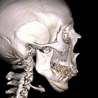     
: 697c4f94.jpg
: 113
:	103,0 
ID:	433268