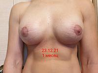     
: cad4ac35.jpg
: 179
:	44,8 
ID:	434516