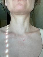     
: 069287be.jpg
: 198
:	40,1 
ID:	463229