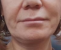     
: 176f90cf.jpg
: 197
:	71,3 
ID:	464863