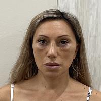     
: eba3e6c8.jpg
: 323
:	77,8 
ID:	467719
