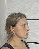     
: 8cad75df.jpg
: 213
:	70,8 
ID:	468847