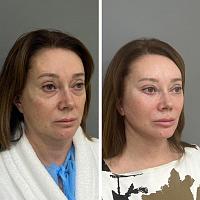 ������� �� ����������� ��� ����������
��������: 52582677.jpg
����������: 367
������:	60,0 ��
ID:	481262
