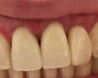     
: bef51827.jpg
: 45
:	41,9 
ID:	492750
