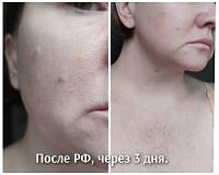 ������� �� ����������� ��� ����������
��������: 1f244122.jpg
����������: 439
������:	57,5 ��
ID:	511034