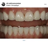 ������� �� ����������� ��� ����������
��������: 6b3d76bc.jpg
����������: 286
������:	46,3 ��
ID:	513870