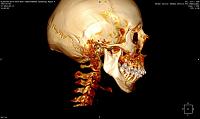     
: f8c394f1.jpg
: 43
:	76,6 
ID:	519473