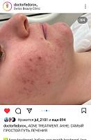 ������� �� ����������� ��� ����������
��������: ea3ca3bb.jpg
����������: 125
������:	39,4 ��
ID:	523208