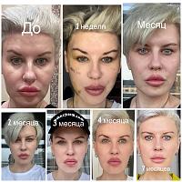 ������� �� ����������� ��� ����������
��������: 72dedccf.jpg
����������: 359
������:	91,3 ��
ID:	528754
