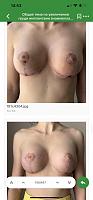     
: 7dfe68a5.jpg
: 67
:	28,7 
ID:	528833