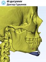    
: 78d5c9e7.jpg
: 61
:	51,5 
ID:	531097