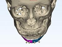     
: 268a3a1e.jpg
: 90
:	212,0 
ID:	532023