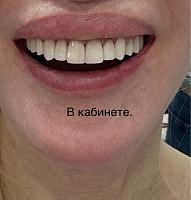     
: bb62c7af.jpg
: 55
:	59,3 
ID:	558134