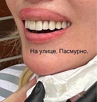     
: 86ed932a.jpg
: 55
:	70,2 
ID:	558135