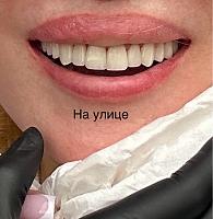     
: fef8781c.jpg
: 49
:	62,7 
ID:	558137