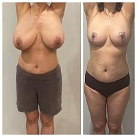 ������� �� ����������� ��� ����������
��������: e8e39f05.jpg
����������: 46
������:	86,7 ��
ID:	563909