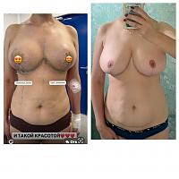     
: a37c1455.jpg
: 11
:	101,9 
ID:	571388