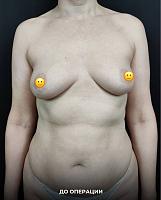 ������� �� ����������� ��� ����������
��������: a3d801a1.jpg
����������: 40
������:	38,8 ��
ID:	591226