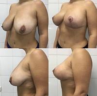 ������� �� ����������� ��� ����������
��������: f9b965b1.jpg
����������: 47
������:	48,5 ��
ID:	601756