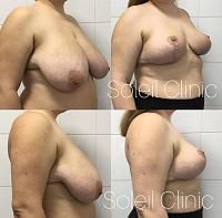 ������� �� ����������� ��� ����������
��������: 3223ab51.jpg
����������: 40
������:	52,2 ��
ID:	601760