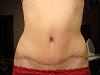     
: 3 mes posle 2 op.JPG
: 199
:	65,0 
ID:	65494